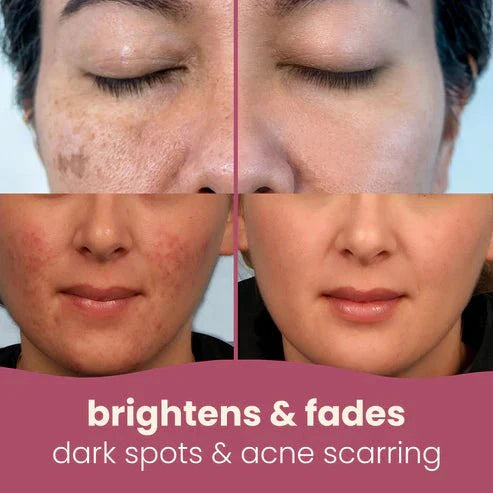 Brightens skin tone Turmeric & Kojic Acid Pads 40 Pads