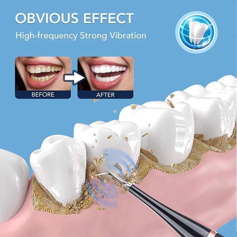 Wavepro Electric Toothbrush