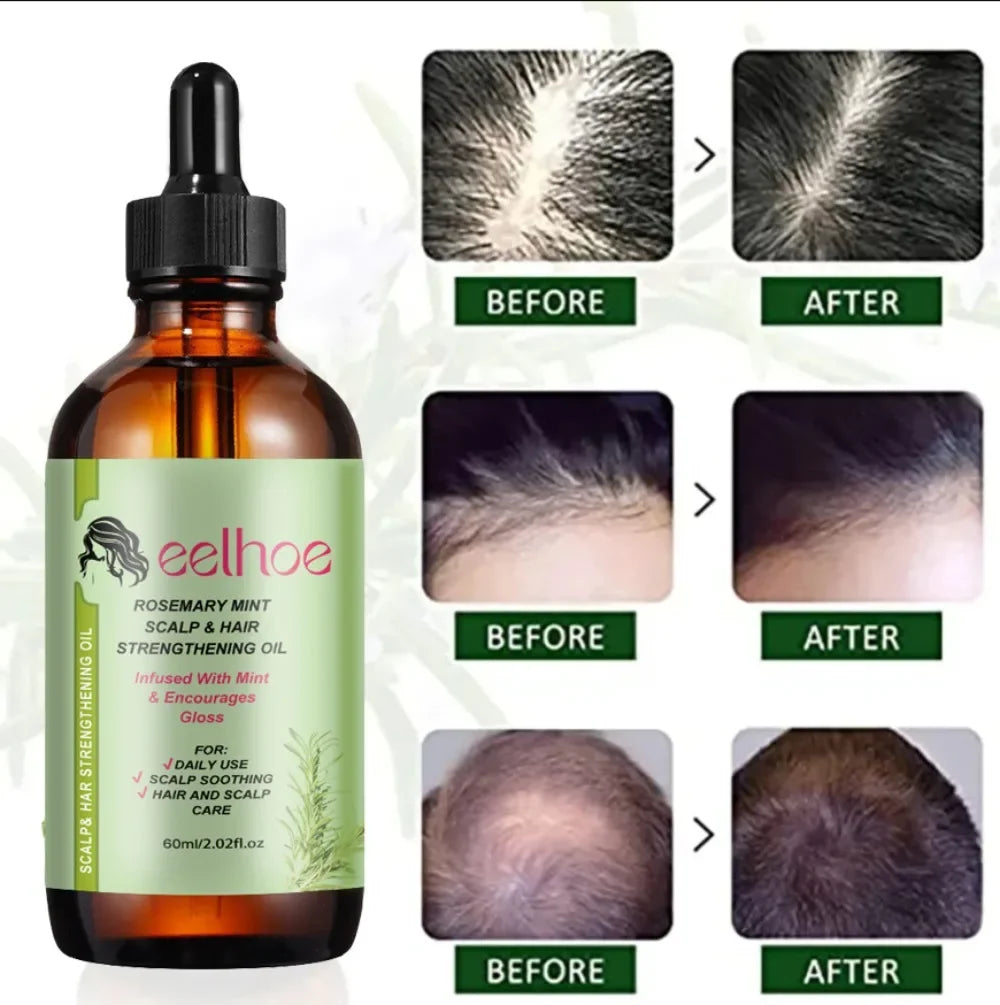 Hair Growth Strengthening Rosemary Mint Oil