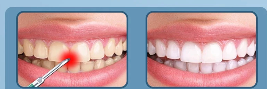 Wavepro Electric Toothbrush