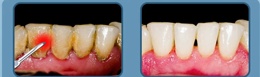 Wavepro Electric Toothbrush